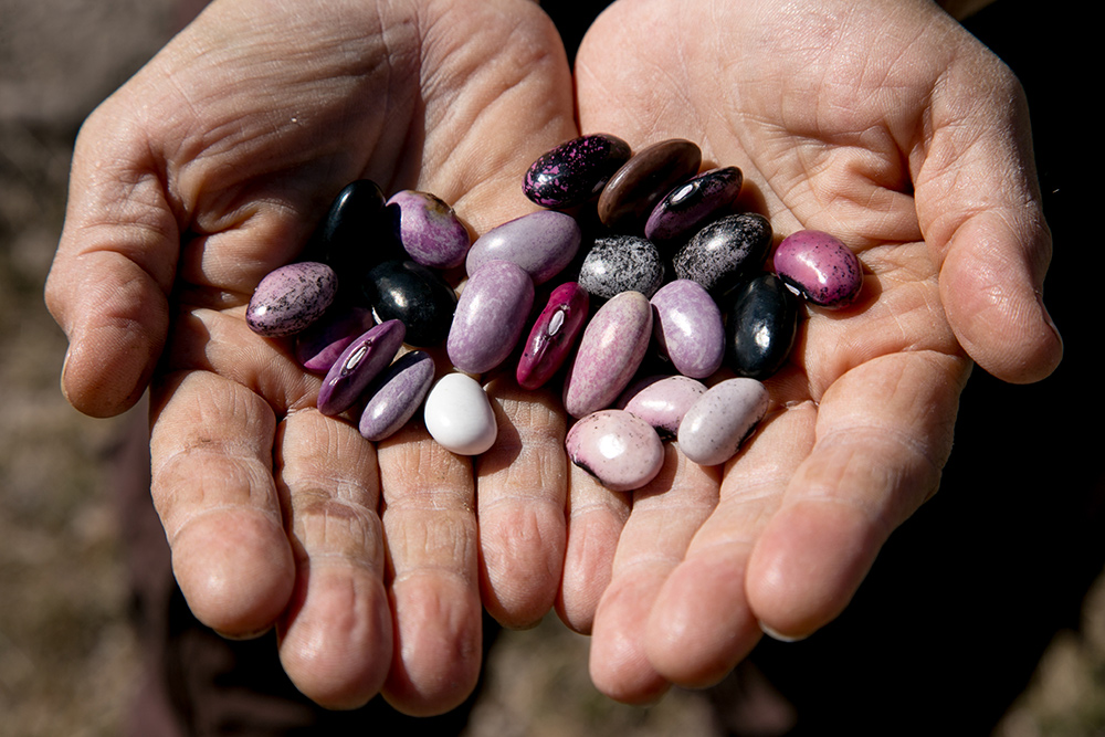 close-up-of-two-hands-with-colorful-beans-note-the-blisters-forming