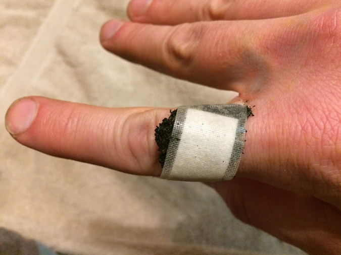 If the area to be treated is small, a simple adhesive bandage can easily hold your poultice in place. (The Grow Network)