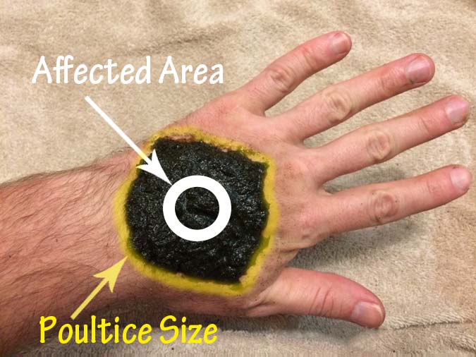 A good rule of thumb is to make your poultice large enough to cover twice the size of the area to be treated. (The Grow Network)