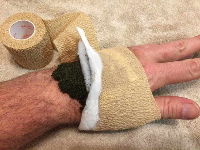 Knowing how to make a poultice also means finding an effective way to make it stay put. (The Grow Network)