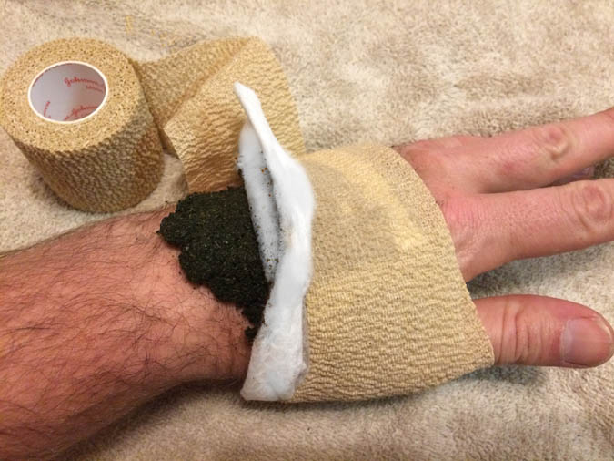 How To Make A Poultice Even For Hard To Treat Areas The Grow